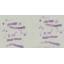 Assises25_Cas1a_TissusMousSein_CCB