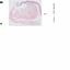 Assises25_Cas3 5a_Digestif_NW_Lesion 5 1.