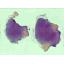 Assises25_Cas7_Dermato_NM