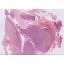 Assises25_Cas5_Gyneco_SC_RI047-01-002HES